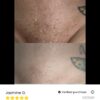 Her Fantasy Box Renew Her Yoni Oil - For Dryness, Ingrown Hair, Dark Marks & Scars